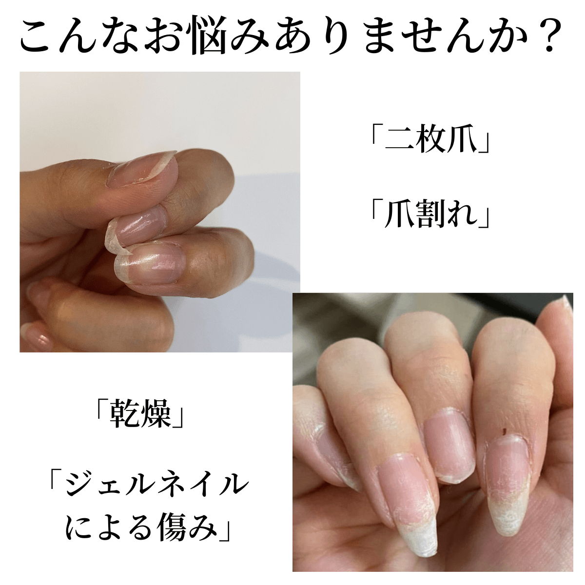 【宅配送料無料】 育爪マニキュアセット OPI opi ジェルブレイク セラムベースコート 人気色 プランピングトップコート プロスパ  キューティクルオイル トゥゴー 爪割れ 二枚爪 薄爪 保湿 ささくれ ネイルケア オイル お得 セット