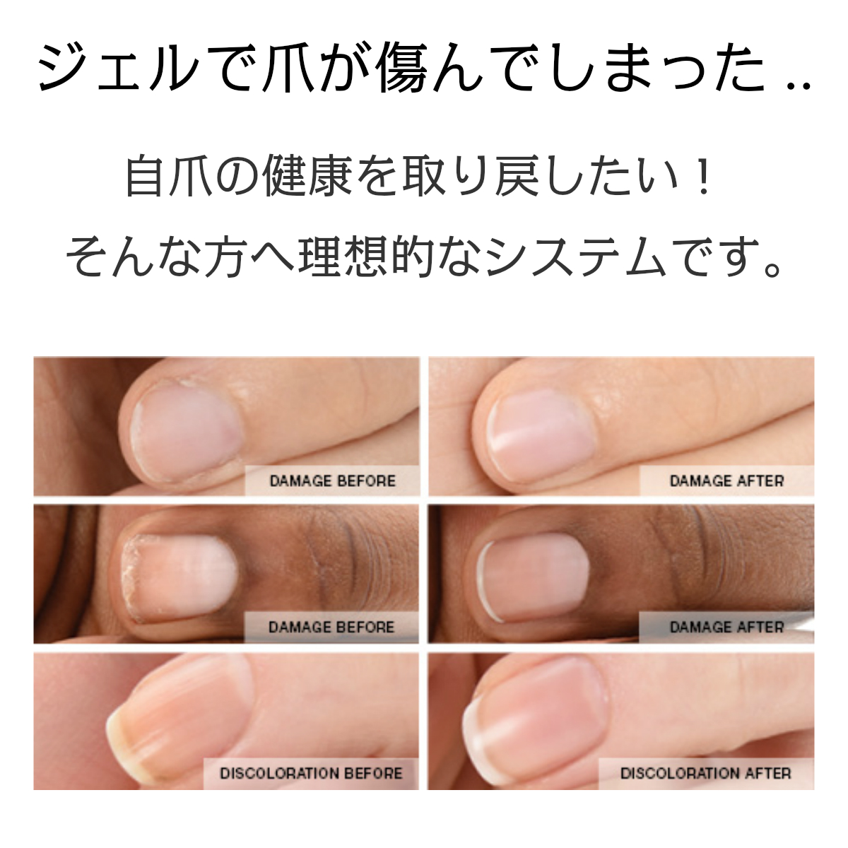 Zoya ゾーヤ ネイキッドマニキュア ネイキッドベース 15ml 補強 成長促進 ベースコート 強化